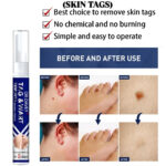 Dr. Davey Maximum Strength Tag & Wart Remover - 16ml - Image 2