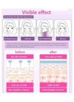 NTFS BEAUTY Facial Steamer - Image 5